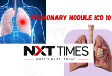 Pulmonary Nodule ICD 10